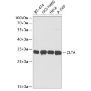 Western blot analysis of extracts of various cell lines using CLTA Antibody (1/3000 dilution).