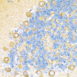 Cytochrome C Oxidase Subunit 6A1 (COX6A1) Antibody