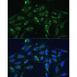Cytochrome C Oxidase Subunit 6A1 (COX6A1) Antibody