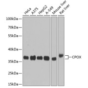 Western blot analysis of extracts of various cell lines using CPOX Antibody (1/1000 dilution).