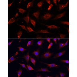 Deoxyribonuclease I Like 1 (DNASE1L1) Antibody