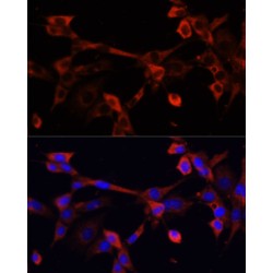 Deoxyribonuclease I Like 1 (DNASE1L1) Antibody