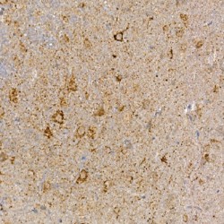 Segment Polarity Protein Dishevelled Homolog DVL-3 (DVL3) Antibody