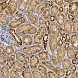Segment Polarity Protein Dishevelled Homolog DVL-3 (DVL3) Antibody