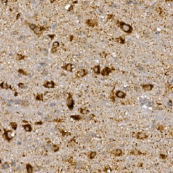 Segment Polarity Protein Dishevelled Homolog DVL-3 (DVL3) Antibody