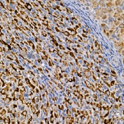 Segment Polarity Protein Dishevelled Homolog DVL-3 (DVL3) Antibody