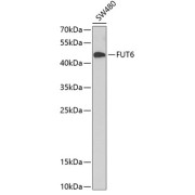 Western blot analysis of extracts of SW480 cells using FUT6 Antibody (1/1000 dilution).