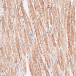G Protein-Coupled Receptor Kinase 5 (GRK5) Antibody