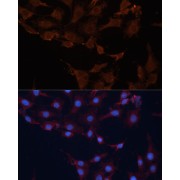 abx002857