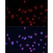 Immunofluorescence analysis of C6 cells using HNRNPU Antibody (1/100 dilution). Blue: DAPI for nuclear staining.