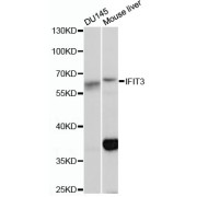 Western blot analysis of extracts of various cell lines using IFIT3 Antibody (1/1000 dilution).