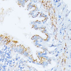 Interleukin 3 Receptor alpha (IL3RA) Antibody