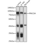 Western blot analysis of extracts of various cell lines using PRKCSH Antibody (1/1000 dilution).