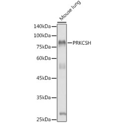 Protein Kinase C Substrate 80K-H (PRKCSH) Antibody