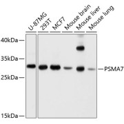 Western blot analysis of extracts of various cell lines using PSMA7 Antibody (1/1000 dilution).