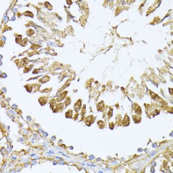 Proteasome Subunit Alpha Type 7 (PSMA7) Antibody