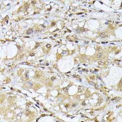 Proteasome Subunit Alpha Type 7 (PSMA7) Antibody