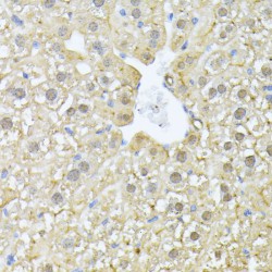 Proteasome Subunit Alpha Type 7 (PSMA7) Antibody