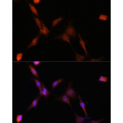 Proteasome Subunit Alpha Type 7 (PSMA7) Antibody