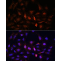Proteasome Subunit Alpha Type 7 (PSMA7) Antibody