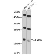 Western blot analysis of extracts of various cell lines using RAP2B Antibody (1/1000 dilution).
