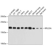 Western blot analysis of extracts of various cell lines using RPL23A Antibody (1/1000 dilution).