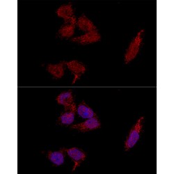 Ribosomal Protein L23A (RPL23A) Antibody