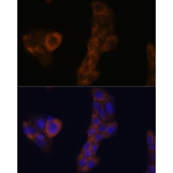 Ribosomal Protein L23A (RPL23A) Antibody
