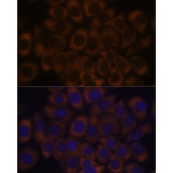 Ribosomal Protein L23A (RPL23A) Antibody