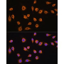 Solute Carrier Family 20 Member 1 (SLC20A1) Antibody
