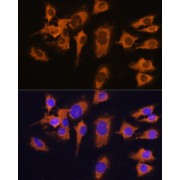 Immunofluorescence analysis of C6 cells using SLC20A1 Antibody (1/100 dilution). Blue: DAPI for nuclear staining.