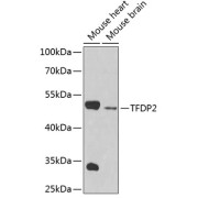 Western blot analysis of extracts of various cell lines using TFDP2 Antibody (1/1000 dilution).
