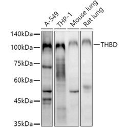 Thrombomodulin (THBD) Antibody