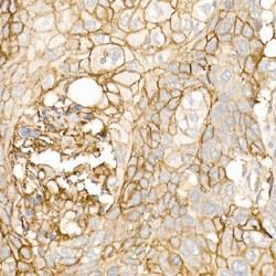 Thrombomodulin (THBD) Antibody