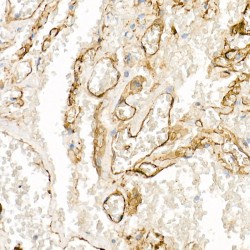 Thrombomodulin (THBD) Antibody