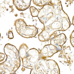 Thrombomodulin (THBD) Antibody