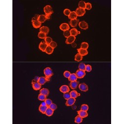 Thrombomodulin (THBD) Antibody