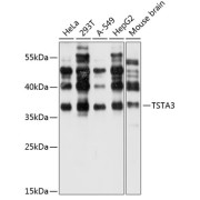 Western blot analysis of extracts of various cell lines using TSTA3 Antibody (1/1000 dilution).