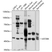 Western blot analysis of extracts of various cell lines using UGT2B4 Antibody (1/1000 dilution).