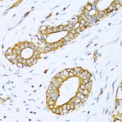 Valyl tRNA Synthetase (VARS) Antibody