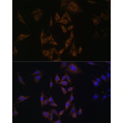 Ubiquitin/ISG15-Conjugating Enzyme E2 L6 (UBE2L6) Antibody