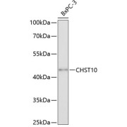 Western blot analysis of extracts of BxPC-3 cells using CHST10 Antibody (1/3000 dilution).