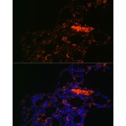 Immunofluorescence analysis of Rat lung using ABCG1 Antibody (1/100 dilution). Blue: DAPI for nuclear staining.