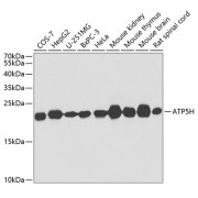 Western blot analysis of extracts of various cell lines using ATP5H Antibody (1/1000 dilution).