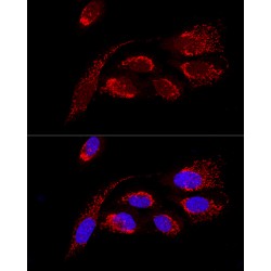 ATP Synthase Subunit D, Mitochondrial (ATP5PD) Antibody
