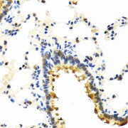 Immunohistochemistry of paraffin-embedded Rat lung using CRTAP Antibody (1/100 dilution, 40x lens).