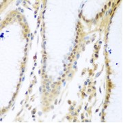 Immunohistochemistry of paraffin-embedded Human stomach using MYBBP1A Antibody (1/100 dilution, 40x lens).