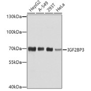 Western blot analysis of extracts of various cell lines using IGF2BP3 Antibody (1/1000 dilution).