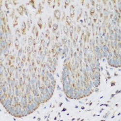 Insulin Like Growth Factor 2 mRNA Binding Protein 3 (IGF2BP3) Antibody