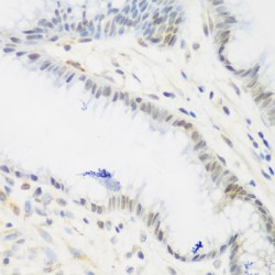 Insulin Like Growth Factor 2 mRNA Binding Protein 3 (IGF2BP3) Antibody